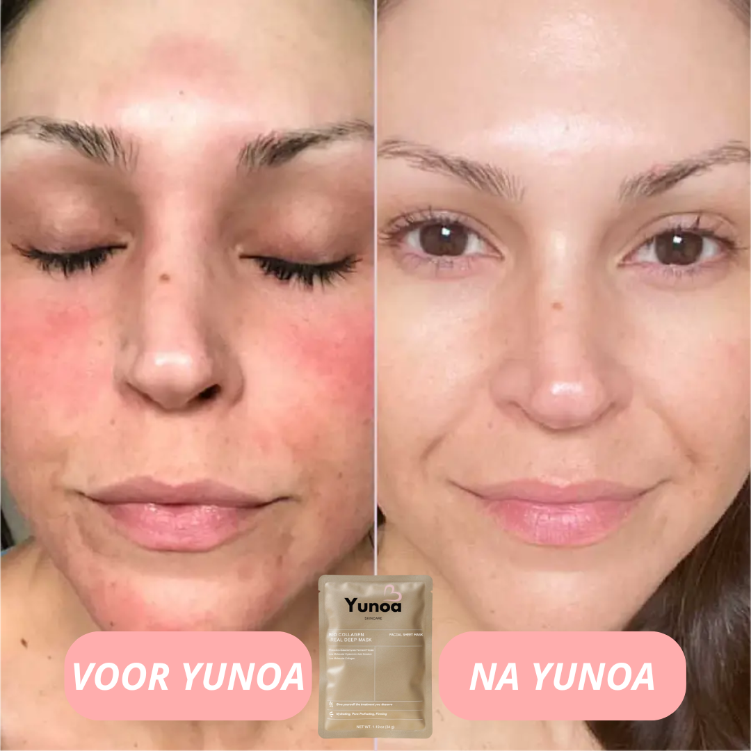 bio-collageen masker | Direct Stralend Resultaat